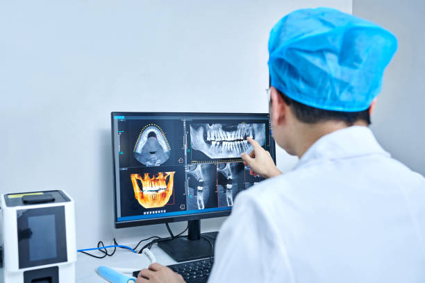 Best Emergency Wisdom Teeth Removal in Summersville, WV